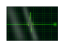 Cardiogram